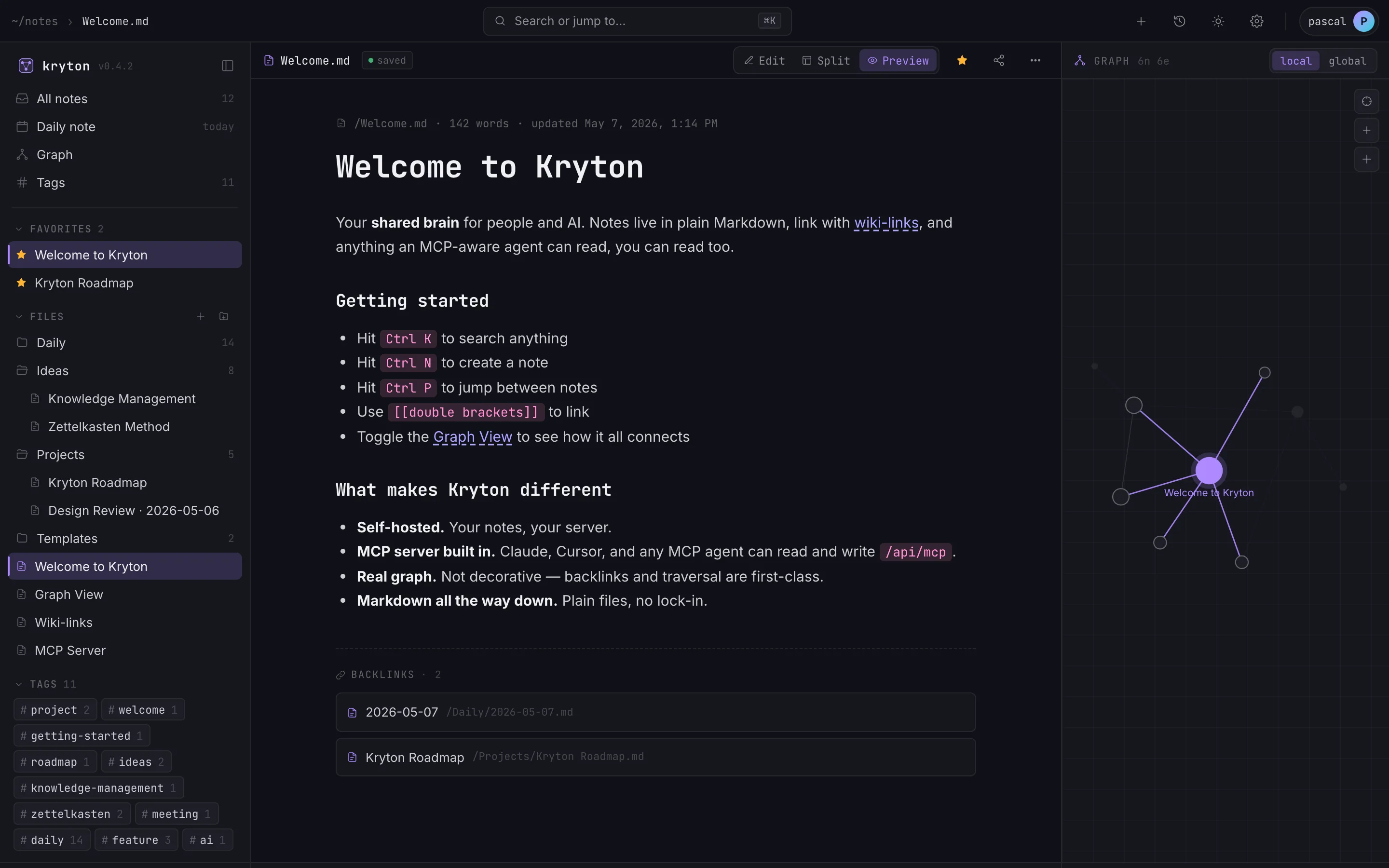Rendered note preview with headings, code, and inline links.